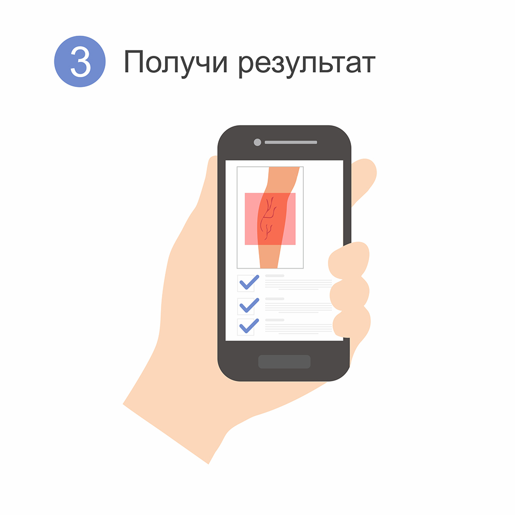 Клиника Флеболог - лечение варикоза лазером - Диагностика варикоза по фото